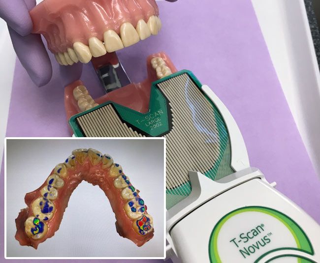 T-Scan, Zahnarztpraxis Wolfratshausen Onesmile